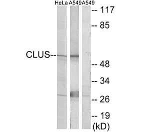 Western Blot - Anti-CLUS Antibody (C13035) - Antibodies.com