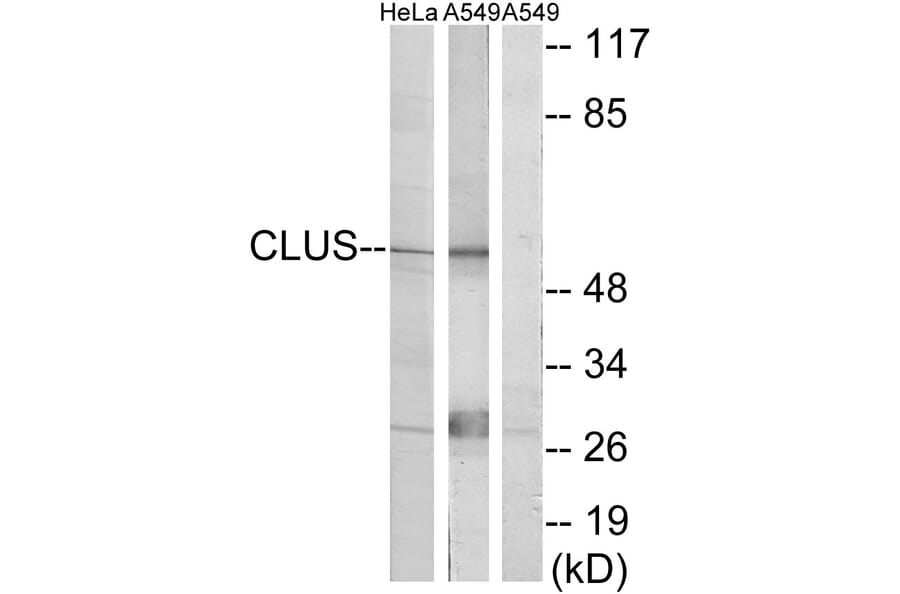 Western Blot - Anti-CLUS Antibody (C13035) - Antibodies.com