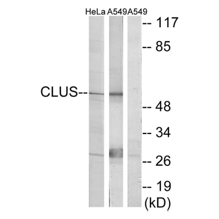 Western Blot - Anti-CLUS Antibody (C13035) - Antibodies.com