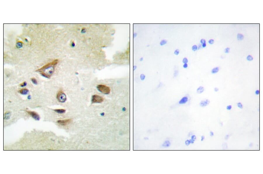 Immunohistochemistry - Anti-CLUS Antibody (C13035) - Antibodies.com