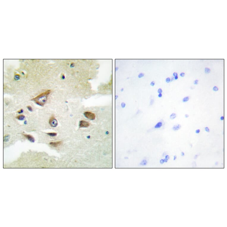 Immunohistochemistry - Anti-CLUS Antibody (C13035) - Antibodies.com