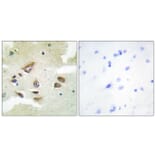 Immunohistochemistry - Anti-CLUS Antibody (C13035) - Antibodies.com
