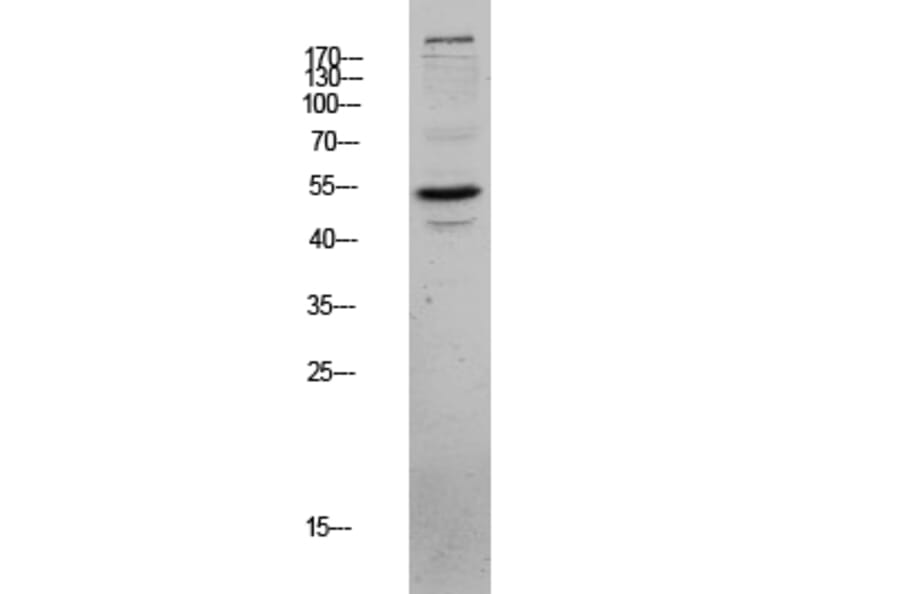 Western Blot - Anti-CLUS Antibody (C13035) - Antibodies.com