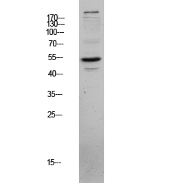 Western Blot - Anti-CLUS Antibody (C13035) - Antibodies.com
