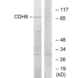 Western Blot - Anti-CDH8 Antibody (C12106) - Antibodies.com