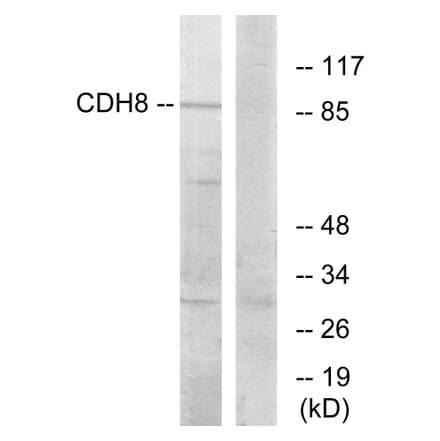 Western Blot - Anti-CDH8 Antibody (C12106) - Antibodies.com