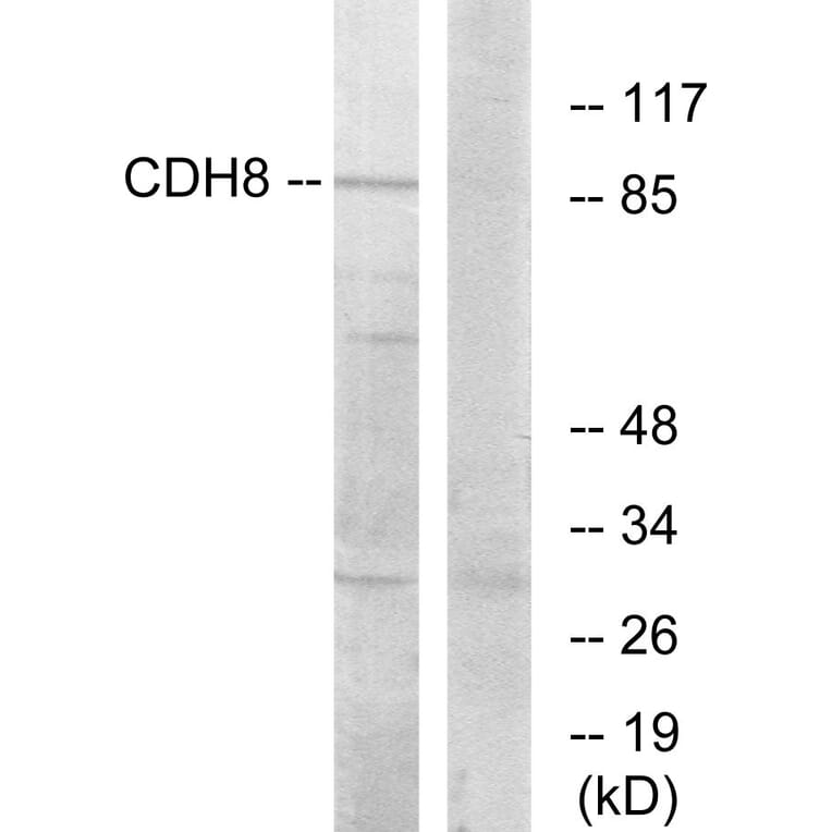 Western Blot - Anti-CDH8 Antibody (C12106) - Antibodies.com