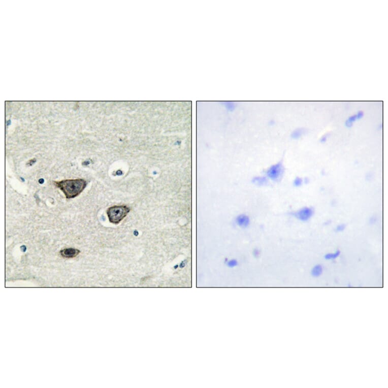 Immunohistochemistry - Anti-CDH8 Antibody (C12106) - Antibodies.com