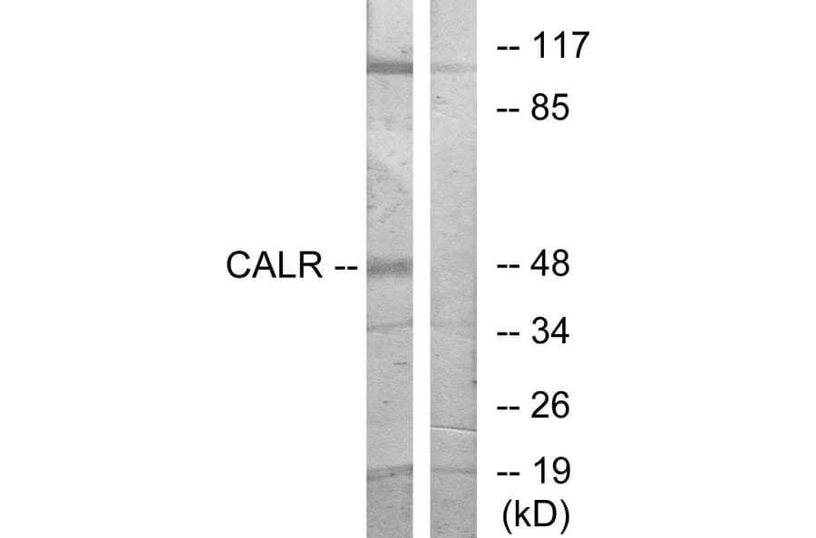 Western Blot - Anti-CALR Antibody (C10495) - Antibodies.com