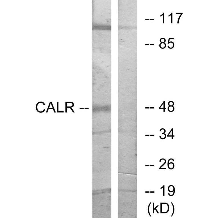 Western Blot - Anti-CALR Antibody (C10495) - Antibodies.com
