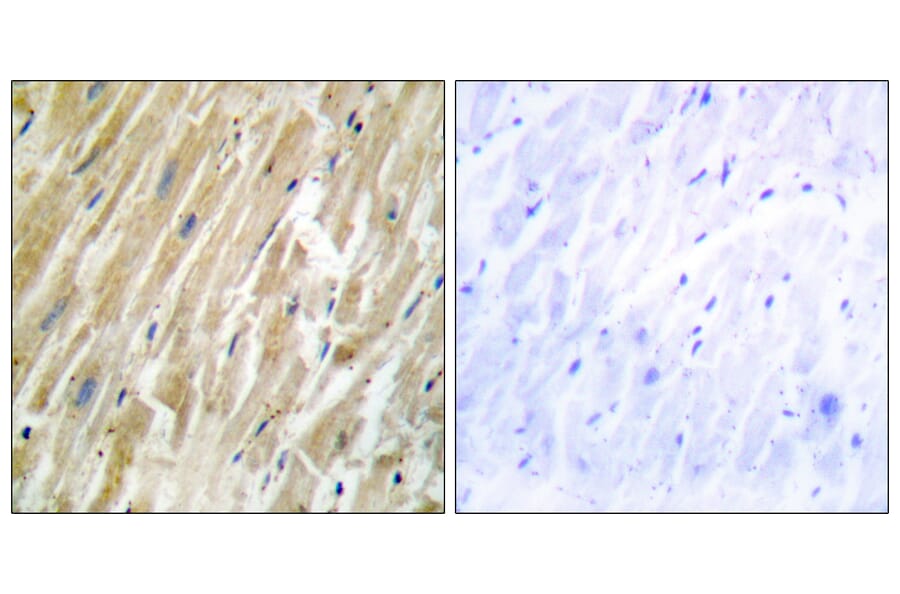 Immunohistochemistry - Anti-CALR Antibody (C10495) - Antibodies.com