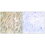 Immunohistochemistry - Anti-CALR Antibody (C10495) - Antibodies.com