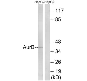 Western Blot - Anti-AurB Antibody (B1133) - Antibodies.com