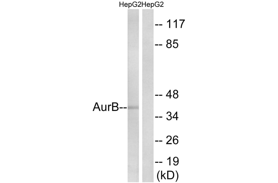 Western Blot - Anti-AurB Antibody (B1133) - Antibodies.com
