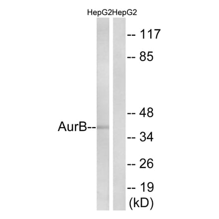 Western Blot - Anti-AurB Antibody (B1133) - Antibodies.com