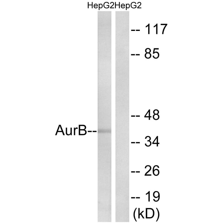 Western Blot - Anti-AurB Antibody (B1133) - Antibodies.com