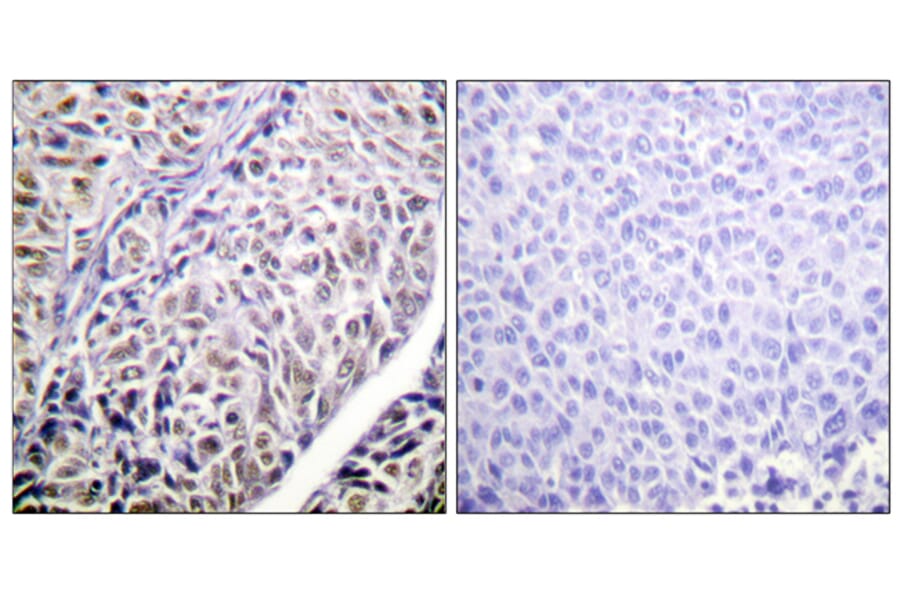 Immunohistochemistry - Anti-AurB Antibody (B1133) - Antibodies.com