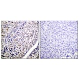 Immunohistochemistry - Anti-AurB Antibody (B1133) - Antibodies.com