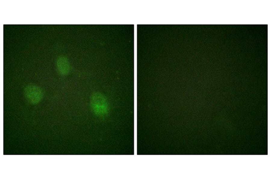 Immunofluorescence - Anti-AurB Antibody (B1133) - Antibodies.com