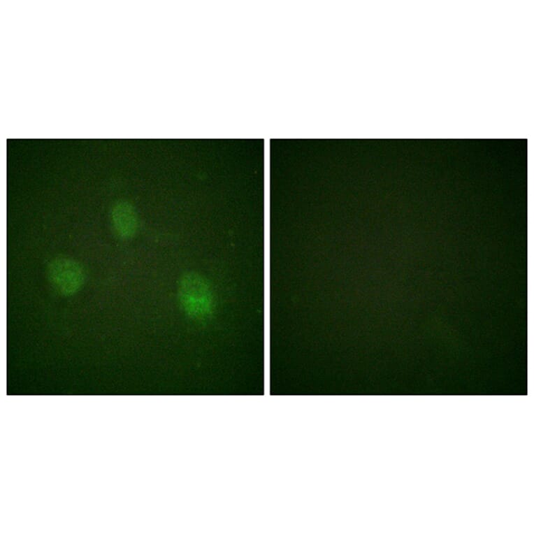 Immunofluorescence - Anti-AurB Antibody (B1133) - Antibodies.com