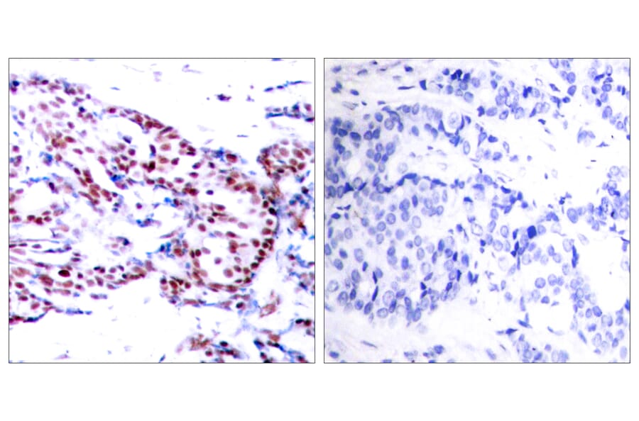 Immunohistochemistry - Anti-ATF2 Antibody (B7015) - Antibodies.com