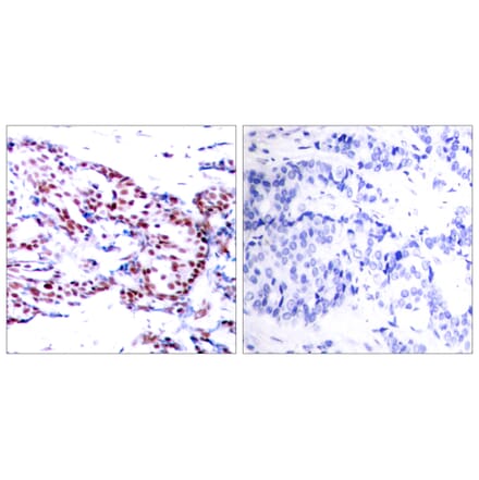 Immunohistochemistry - Anti-ATF2 Antibody (B7015) - Antibodies.com