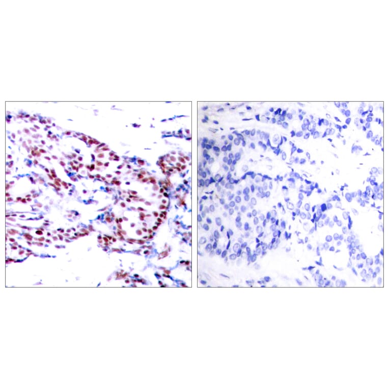 Immunohistochemistry - Anti-ATF2 Antibody (B7015) - Antibodies.com