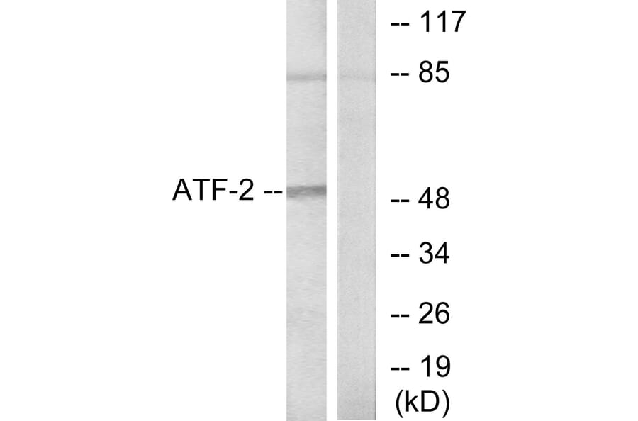 Western Blot - Anti-ATF2 Antibody (B7015) - Antibodies.com