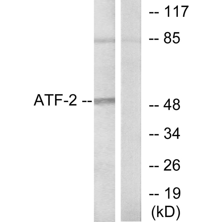 Western Blot - Anti-ATF2 Antibody (B7015) - Antibodies.com