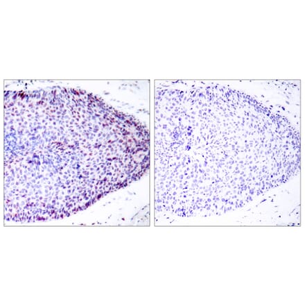 Immunohistochemistry - Anti-ATF2 Antibody (B7013) - Antibodies.com