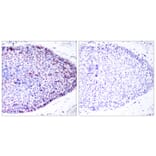 Immunohistochemistry - Anti-ATF2 Antibody (B7013) - Antibodies.com