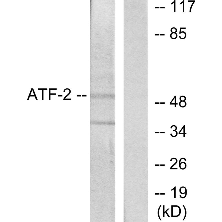 Western Blot - Anti-ATF2 Antibody (B7013) - Antibodies.com