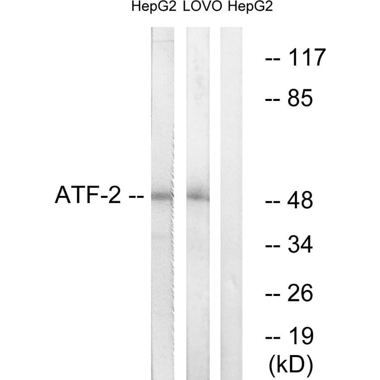 Western Blot - Anti-ATF2 Antibody (B7014) - Antibodies.com