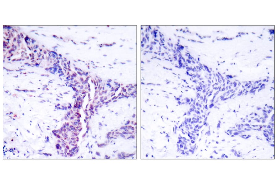 Immunohistochemistry - Anti-ATF2 Antibody (B7016) - Antibodies.com