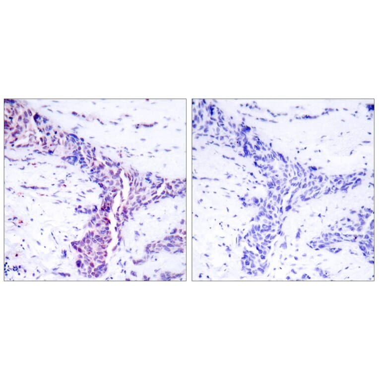 Immunohistochemistry - Anti-ATF2 Antibody (B7016) - Antibodies.com