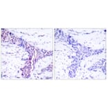 Immunohistochemistry - Anti-ATF2 Antibody (B7016) - Antibodies.com