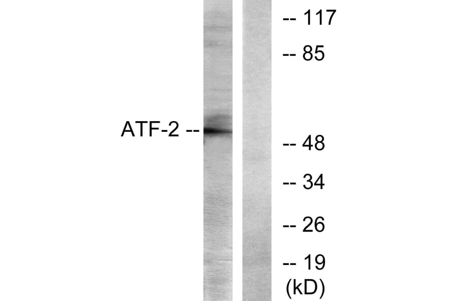 Western Blot - Anti-ATF2 Antibody (B7016) - Antibodies.com