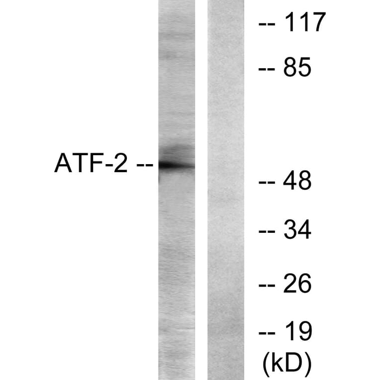 Western Blot - Anti-ATF2 Antibody (B7016) - Antibodies.com