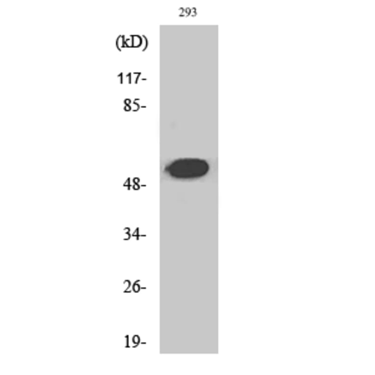 Western Blot - Anti-PLMN (heavy chain A short form, cleaved Val98) Antibody (L0370) - Antibodies.com