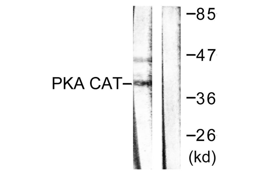 Western Blot - Anti-PKA alpha + beta (catalytic subunits) Antibody (B0548) - Antibodies.com
