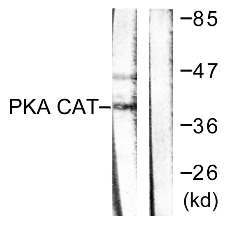 Western Blot - Anti-PKA alpha + beta (catalytic subunits) Antibody (B0548) - Antibodies.com