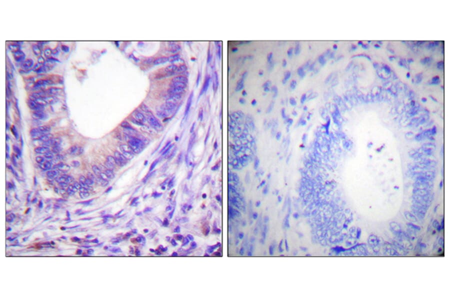 Immunohistochemistry - Anti-PKA alpha + beta (catalytic subunits) Antibody (B0548) - Antibodies.com