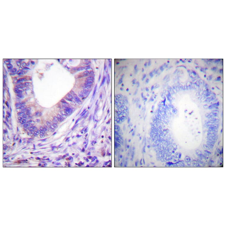 Immunohistochemistry - Anti-PKA alpha + beta (catalytic subunits) Antibody (B0548) - Antibodies.com