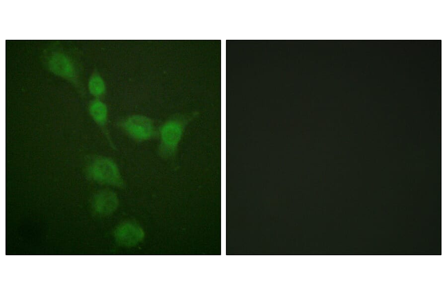 Immunofluorescence - Anti-PKA alpha + beta (catalytic subunits) Antibody (B0548) - Antibodies.com