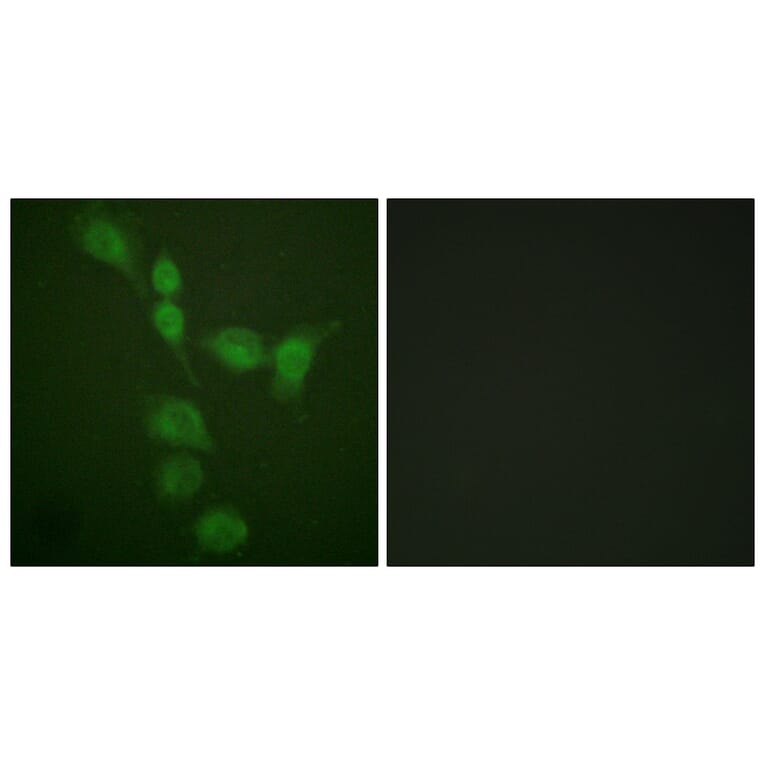Immunofluorescence - Anti-PKA alpha + beta (catalytic subunits) Antibody (B0548) - Antibodies.com
