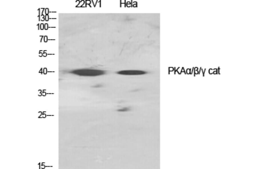 Western Blot - Anti-PKA alpha + beta (catalytic subunits) Antibody (B0548) - Antibodies.com