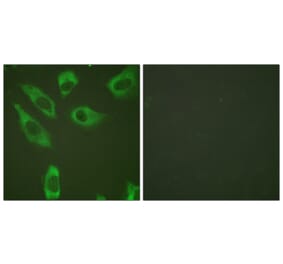 Immunofluorescence - Anti-S6 Ribosomal Protein (phospho Ser240) Antibody (A0571) - Antibodies.com