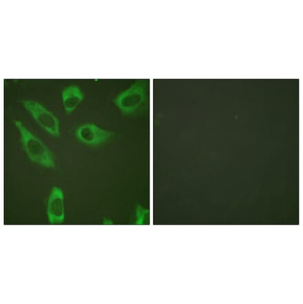 Immunofluorescence - Anti-S6 Ribosomal Protein (phospho Ser240) Antibody (A0571) - Antibodies.com