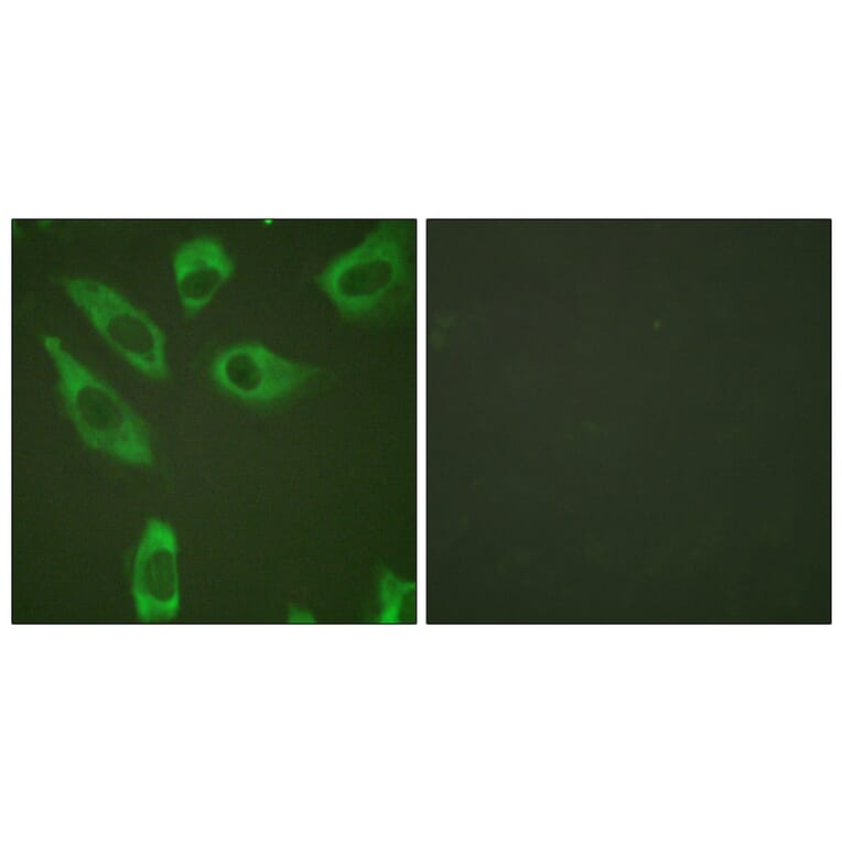 Immunofluorescence - Anti-S6 Ribosomal Protein (phospho Ser240) Antibody (A0571) - Antibodies.com