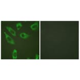 Immunofluorescence - Anti-S6 Ribosomal Protein (phospho Ser240) Antibody (A0571) - Antibodies.com